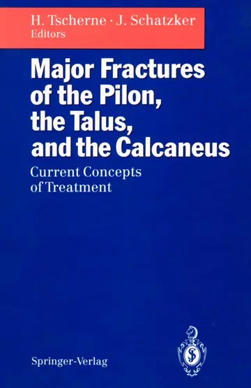 Cover of Major Fractures of the Pilon, the Talus, and the Calcaneus