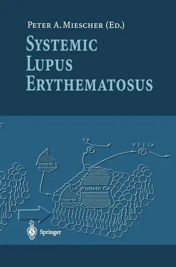 Cover of Systemic Lupus Erythematosus