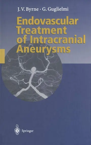 Cover of Endovascular Treatment of Intracranial Aneurysms