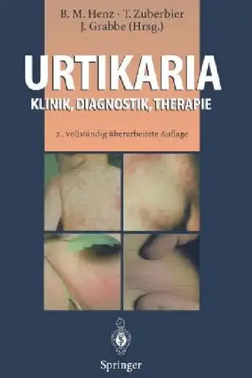 Cover of Urtikaria