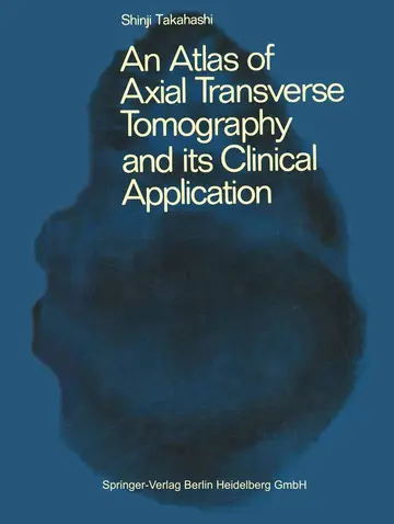 Cover of An Atlas of Axial Transverse Tomography and Its Clinical Application
