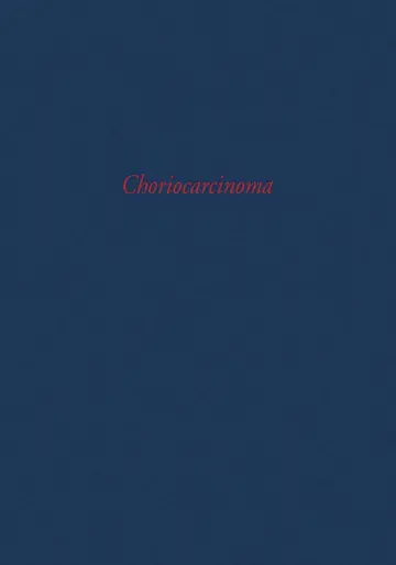 Cover of Choriocarcinoma