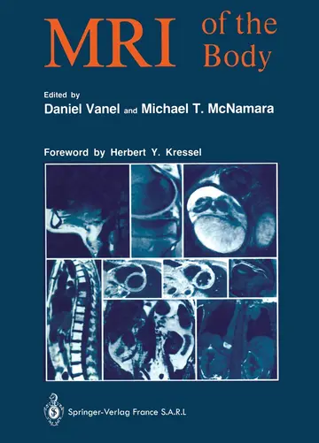 Cover of MRI of the Body