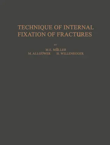 Cover of Technique of Internal Fixation of Fractures