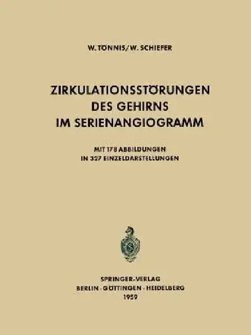 Cover of Zirkulationsstörungen Des Gehirns Im Serienangiogramm