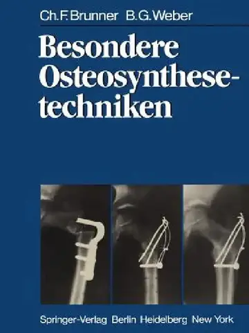 Cover of Besondere Osteosynthesetechniken