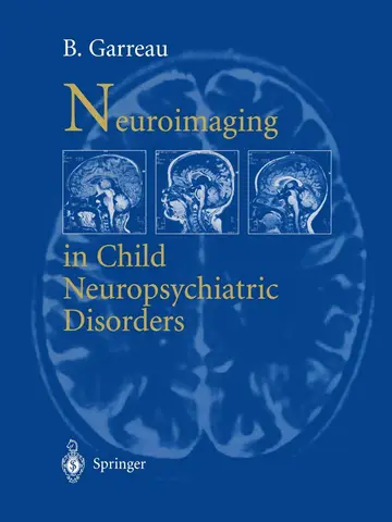 Cover of Neuroimaging in Child Neuropsychiatric Disorders