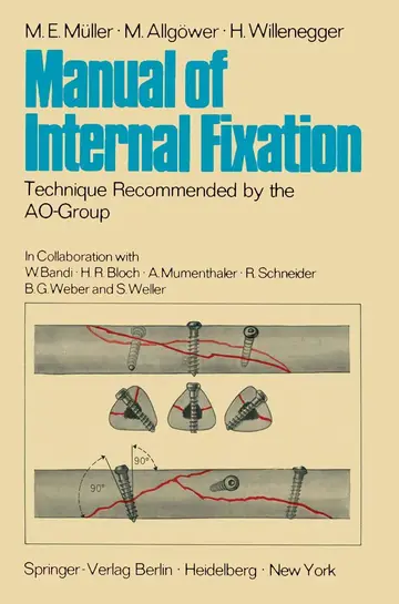 Cover of Manual of Internal Fixation