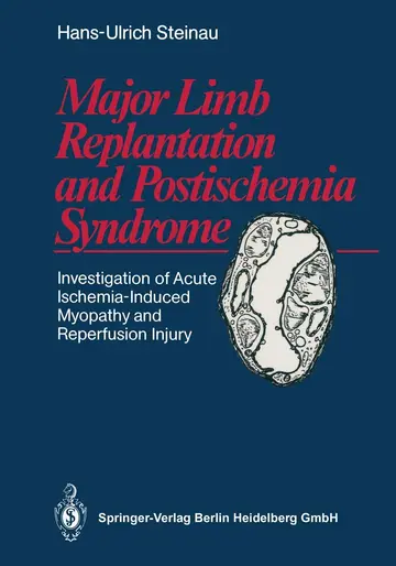 Cover of Major Limb Replantation and Postischemia Syndrome