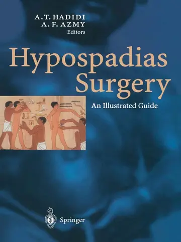 Cover of Hypospadias Surgery