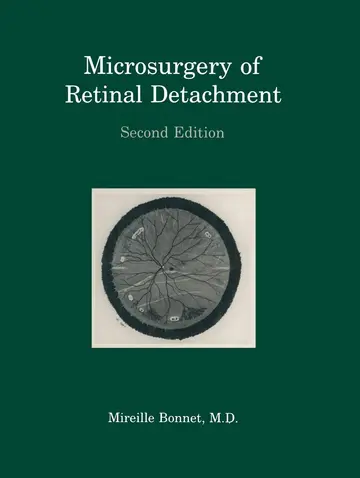 Cover of Microsurgery of Retinal Detachment