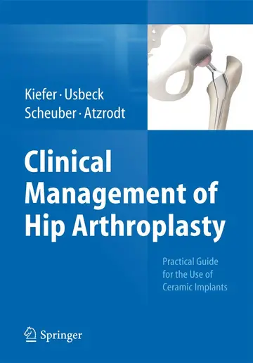 Cover of Clinical Management of Hip Arthroplasty