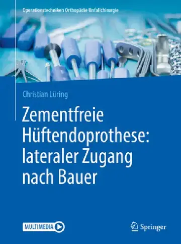 Cover of Zementfreie Hüftendoprothese