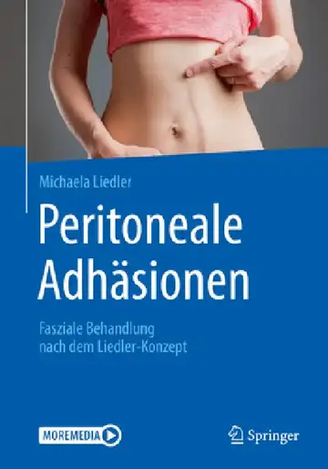 Cover of Peritoneale Adhäsionen