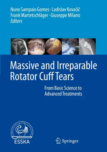 Cover of Massive and Irreparable Rotator Cuff Tears