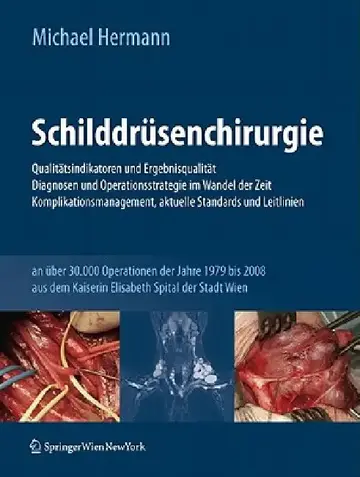 Cover of Schilddrüsenchirurgie - Qualitätsindikatoren Und Ergebnisqualität, Diagnosen Und Operationsstrategie Im Wandel Der Zeit, Komplikationsmanagement, Aktu