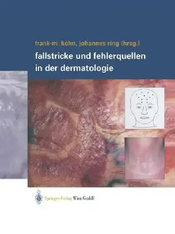 Cover of Fallstricke Und Fehlerquellen in Der Dermatologie