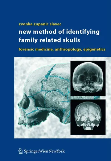 Cover of New Method of Identifying Family Related Skulls