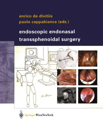 Cover of Endoscopic Endonasal Transsphenoidal Surgery
