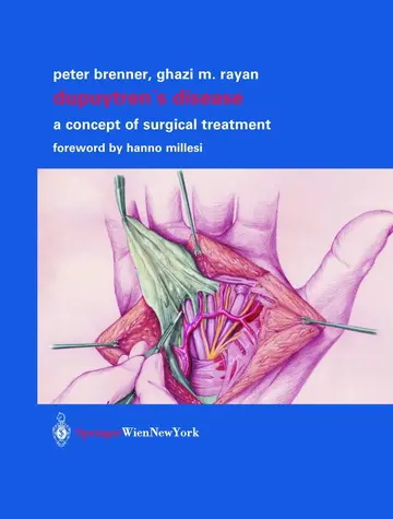 Cover of Dupuytren’s Disease