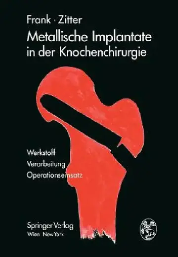 Cover of Metallische Implantate in Der Knochenchirurgie