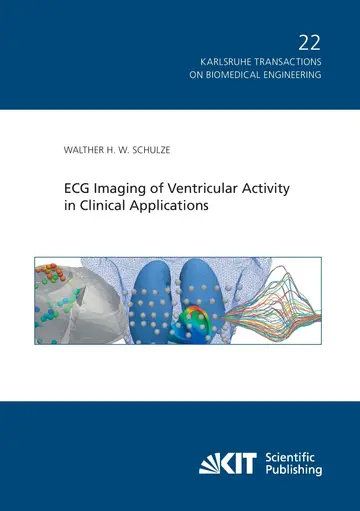Cover of ECG Imaging of Ventricular Activity in Clinical Applications