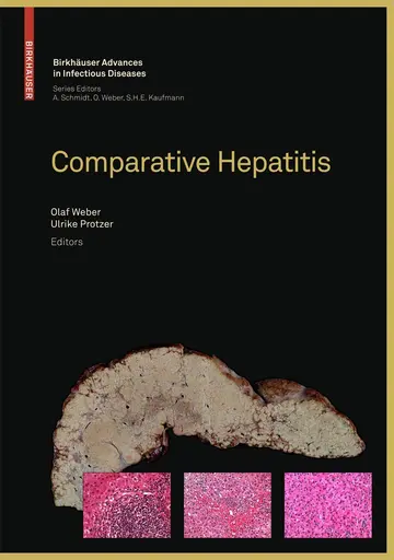 Cover of Comparative Hepatitis