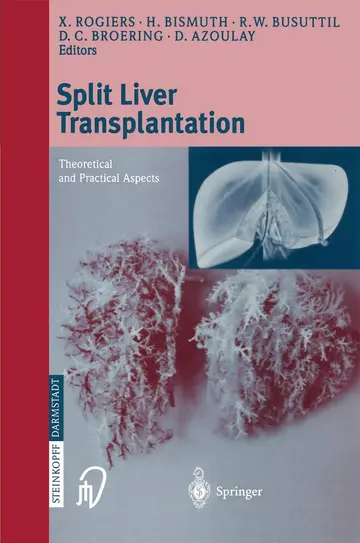 Cover of Split Liver Transplantation