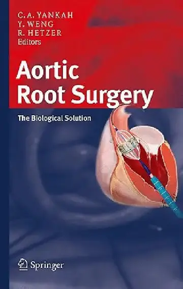 Cover of Aortic Root Surgery