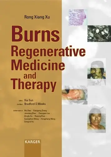 Cover of Burns Regenerative Medicine and Therapy