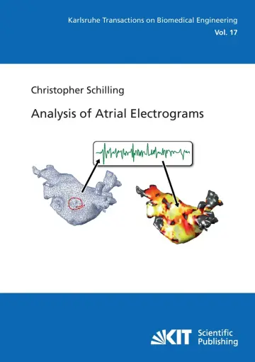 Cover of Analysis of Atrial Electrograms