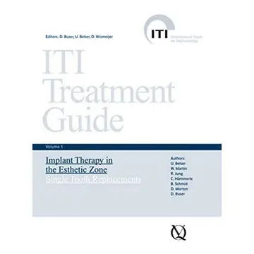 Cover of ITI Treatment Guide
