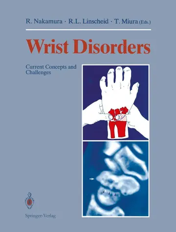 Cover of Wrist Disorders