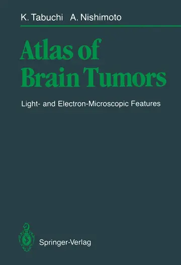 Cover of Atlas of Brain Tumors
