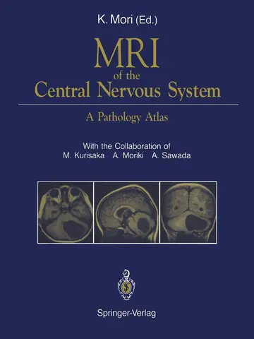 Cover of MRI of the Central Nervous System
