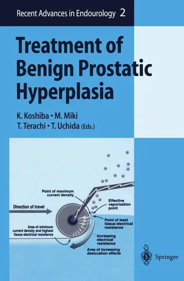Cover of Treatment of Benign Prostatic Hyperplasia