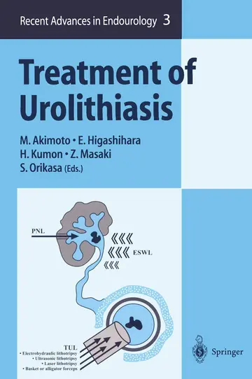 Cover of Treatment of Urolithiasis