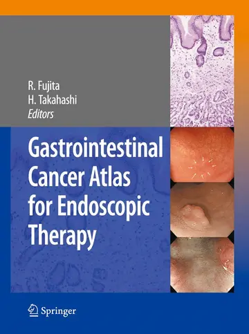Cover of Gastrointestinal Cancer Atlas for Endoscopic Therapy
