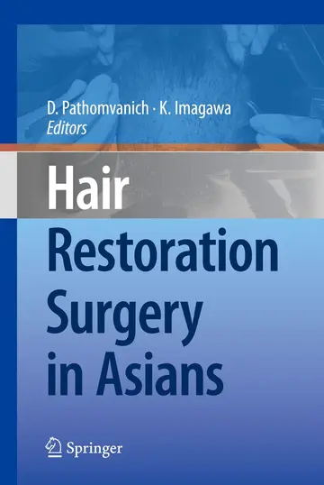 Cover of Hair Restoration Surgery in Asians