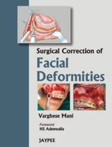 Cover of Surgical Correction of Facial Deformities