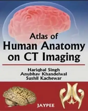Cover of Atlas Of Human Anatomy On Ct Imaging