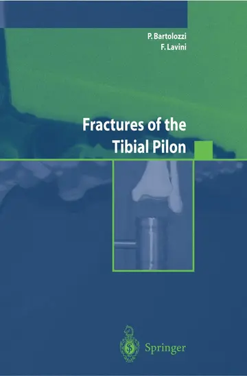 Cover of Fractures of the Tibial Pilon