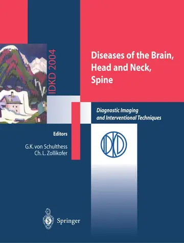 Cover of Diseases of the Brain, Head and Neck, Spine