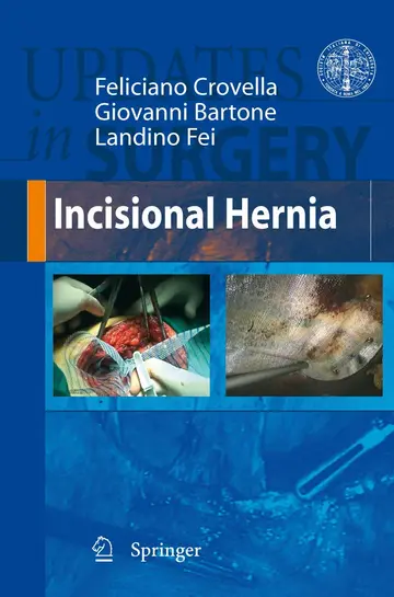 Cover of Incisional Hernia