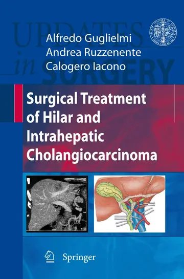 Cover of Surgical Treatment of Hilar and Intrahepatic Cholangiocarcinoma