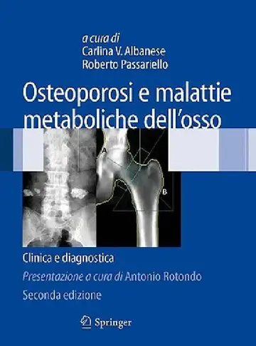 Cover of Osteoporosi E Malattie Metaboliche Dell'osso