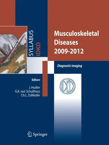 Cover of Musculoskeletal Diseases 2009-2012