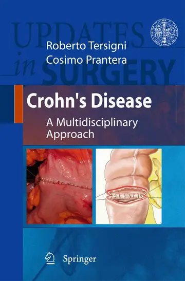 Cover of Crohn's Disease