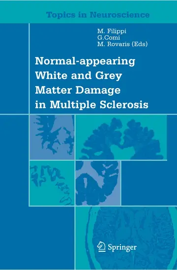 Cover of Normal-Appearing White and Grey Matter Damage in Multiple Sclerosis