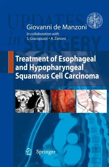 Cover of Treatment of Esophageal and Hypopharingeal Squamous Cell Carcinoma